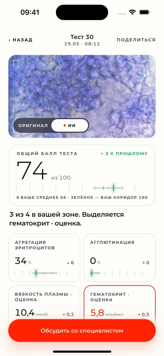 Результат теста: видео капли с разметкой ИИ и четыре показателя
